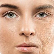 نکته های اساسی برای جلوگیری از پیری زودرس پوست دور چشم