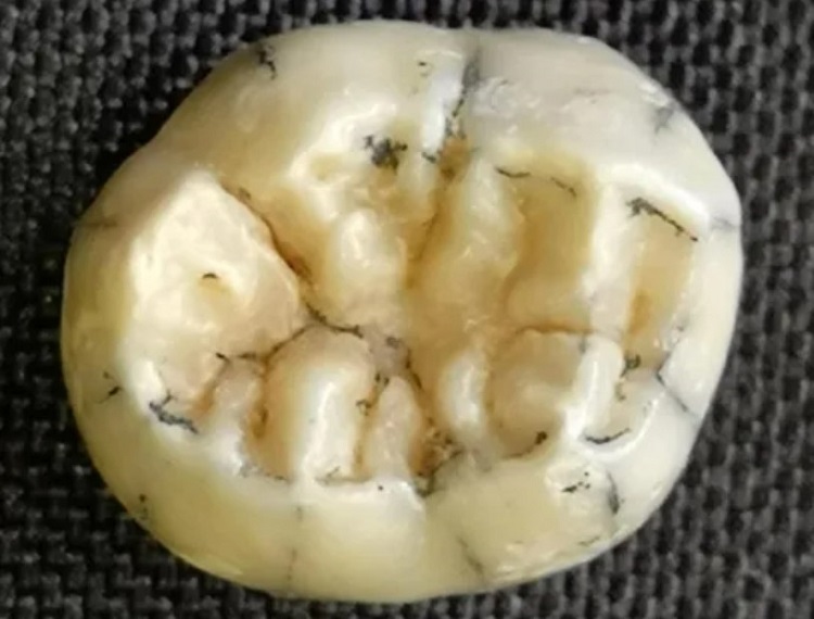 معمای دندان دختر بچه ۱۶۰هزار ساله!