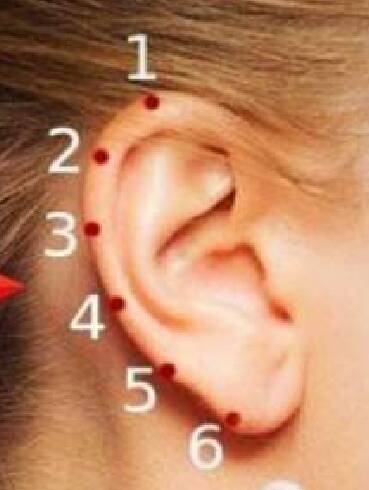 نقاط مخصوص روی گوش برای تسکین درد