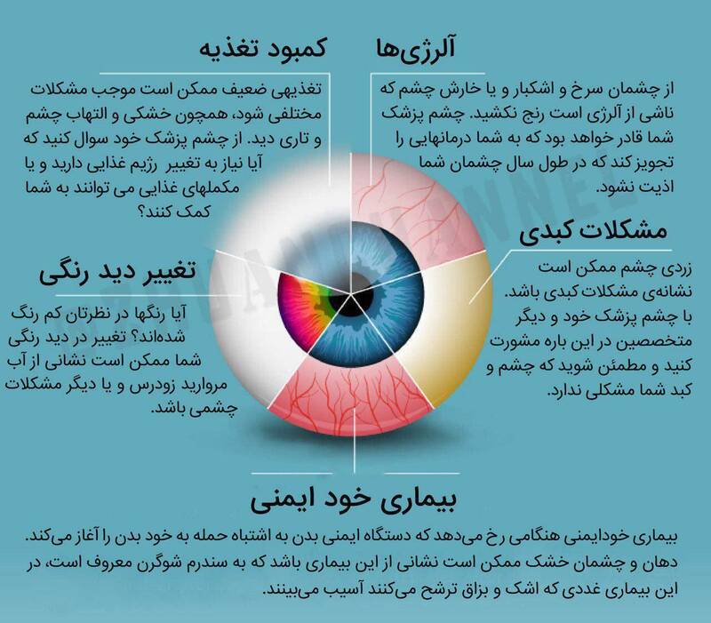 اینفوگرافیک/ بیماری‌هایی که نشانه‌های آن در چشم‌ها بروز می‌کند