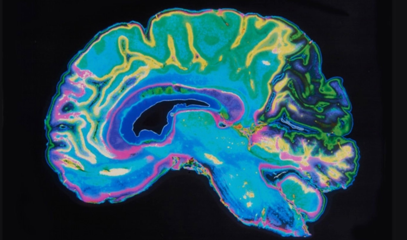 تحقیقات جدید نشان می‌دهد که مخچه مغز عملکردی دارد که ما تا حالا از آن آگاهی نداشتیم