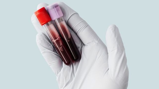 برای نخستین بار در جهان؛ خون تولید‌شده در آزمایشگاه به کمک انسان می‌آید