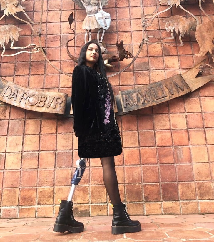 مدل زیبای اکوادوری که دست ها و یک پای خود را از دست داده است